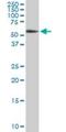 Histone Deacetylase 1 antibody, H00003065-M06, Novus Biologicals, Western Blot image 