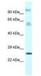 Transmembrane Protein 222 antibody, NBP1-79831, Novus Biologicals, Western Blot image 