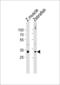 Homeobox B5 antibody, LS-C164980, Lifespan Biosciences, Western Blot image 