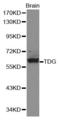 Thymine DNA Glycosylase antibody, A1262, ABclonal Technology, Western Blot image 