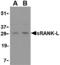 TNF Superfamily Member 11 antibody, MBS150390, MyBioSource, Western Blot image 