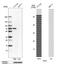 P21 (RAC1) Activated Kinase 1 antibody, NBP1-85802, Novus Biologicals, Western Blot image 