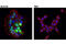 Cellular Retinoic Acid Binding Protein 1 antibody, 13163S, Cell Signaling Technology, Immunocytochemistry image 