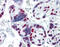 Heterogeneous Nuclear Ribonucleoprotein M antibody, 51-490, ProSci, Immunohistochemistry paraffin image 