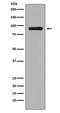 Ribosomal Protein S6 Kinase A1 antibody, P01058-1, Boster Biological Technology, Western Blot image 