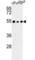 Protein Phosphatase 1 Regulatory Subunit 36 antibody, abx034185, Abbexa, Western Blot image 