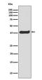 Linker For Activation Of T Cells antibody, P01654, Boster Biological Technology, Western Blot image 