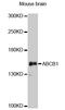 ATP Binding Cassette Subfamily B Member 1 antibody, LS-C749747, Lifespan Biosciences, Western Blot image 