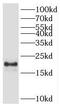 POP7 Homolog, Ribonuclease P/MRP Subunit antibody, FNab06642, FineTest, Western Blot image 