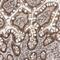 Zinc Finger Homeobox 4 antibody, PA5-54897, Invitrogen Antibodies, Immunohistochemistry frozen image 