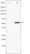 Activating Transcription Factor 2 antibody, TA325238, Origene, Western Blot image 