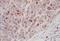 Aurora Kinase B antibody, NB100-294, Novus Biologicals, Immunohistochemistry paraffin image 