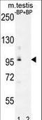 Pyruvate Dehydrogenase Phosphatase Regulatory Subunit antibody, LS-C163500, Lifespan Biosciences, Western Blot image 