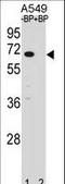 Ankyrin Repeat And SOCS Box Containing 3 antibody, LS-C156534, Lifespan Biosciences, Western Blot image 