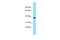 Reticulocalbin 3 antibody, A12684, Boster Biological Technology, Western Blot image 