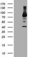Phosphofructokinase, Platelet antibody, TA503999, Origene, Western Blot image 