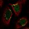 Yip1 Domain Family Member 3 antibody, HPA063699, Atlas Antibodies, Immunofluorescence image 