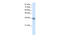 Calcium Voltage-Gated Channel Auxiliary Subunit Gamma 4 antibody, 28-719, ProSci, Western Blot image 