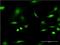 C1D Nuclear Receptor Corepressor antibody, H00010438-M10, Novus Biologicals, Immunocytochemistry image 