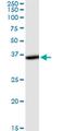 THUMP Domain Containing 1 antibody, MA5-24483, Invitrogen Antibodies, Western Blot image 