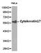 Keratin 17 antibody, LS-C192818, Lifespan Biosciences, Western Blot image 