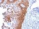 Keratin 17 antibody, NBP2-44425, Novus Biologicals, Immunohistochemistry frozen image 