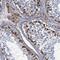 Phosphoglucomutase 2 antibody, NBP2-32601, Novus Biologicals, Immunohistochemistry paraffin image 