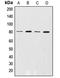 G Protein-Coupled Receptor Kinase 2 antibody, LS-C351799, Lifespan Biosciences, Western Blot image 