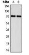 Neurofibromin 2 antibody, orb216168, Biorbyt, Western Blot image 