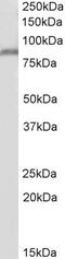 Ectonucleotide Pyrophosphatase/Phosphodiesterase 2 antibody, 43-412, ProSci, Western Blot image 