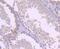 Tubulin Gamma 1 antibody, NBP2-66860, Novus Biologicals, Immunohistochemistry paraffin image 