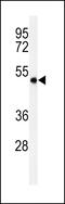 Sphingomyelin Phosphodiesterase Acid Like 3A antibody, MBS9212145, MyBioSource, Western Blot image 