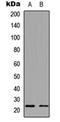 NADH:Ubiquinone Oxidoreductase Subunit B9 antibody, orb256714, Biorbyt, Western Blot image 