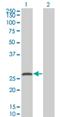 Synaptosome Associated Protein 25 antibody, H00006616-M01, Novus Biologicals, Western Blot image 