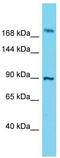 Storkhead Box 2 antibody, TA330702, Origene, Western Blot image 