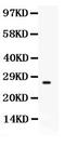 CD63 Molecule antibody, LS-C357414, Lifespan Biosciences, Western Blot image 