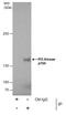 Phosphoinositide-3-Kinase Regulatory Subunit 4 antibody, PA5-28917, Invitrogen Antibodies, Immunoprecipitation image 