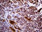 Protein-L-Isoaspartate (D-Aspartate) O-Methyltransferase antibody, LS-C792295, Lifespan Biosciences, Immunohistochemistry paraffin image 