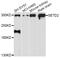 SET Domain Containing 2, Histone Lysine Methyltransferase antibody, STJ113346, St John