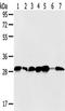 SRP Receptor Subunit Beta antibody, TA350418, Origene, Western Blot image 