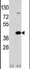 Laforin antibody, PA5-11517, Invitrogen Antibodies, Western Blot image 