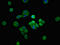 SH3 Domain And Tetratricopeptide Repeats 2 antibody, LS-C674840, Lifespan Biosciences, Immunofluorescence image 