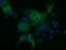 Kelch Like Family Member 2 antibody, GTX84259, GeneTex, Immunofluorescence image 