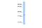 Glutathione S-Transferase Omega 2 antibody, PA5-43306, Invitrogen Antibodies, Western Blot image 