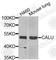 Calumenin antibody, A6538, ABclonal Technology, Western Blot image 