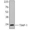 TIMP Metallopeptidase Inhibitor 1 antibody, LS-C41071, Lifespan Biosciences, Western Blot image 
