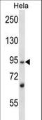 L3MBTL Histone Methyl-Lysine Binding Protein 2 antibody, LS-C165662, Lifespan Biosciences, Western Blot image 