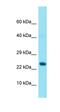 GRB2 Related Adaptor Protein antibody, orb331389, Biorbyt, Western Blot image 