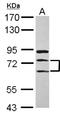 EEF1A Lysine And N-Terminal Methyltransferase antibody, NBP2-17281, Novus Biologicals, Western Blot image 