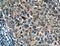 Matrix Metallopeptidase 1 antibody, 26585-1-AP, Proteintech Group, Immunohistochemistry frozen image 